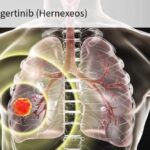 تأیید شتاب‌یافته FDA برای داروی zongertinib ؛ امید تازه بیماران مبتلا به سرطان ریه