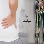 سیاتیک را با گرفتگی عضلات اشتباه نگیرید