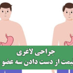 جراحی لاغری به قیمت از دست دادن سه عضو بدن!