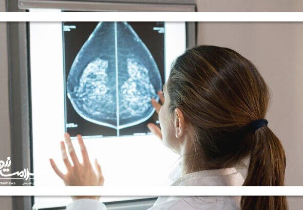 ماموگرافی یا سونوگرافی پستان کدام برای تشخیص سرطان سینه بهتر است؟