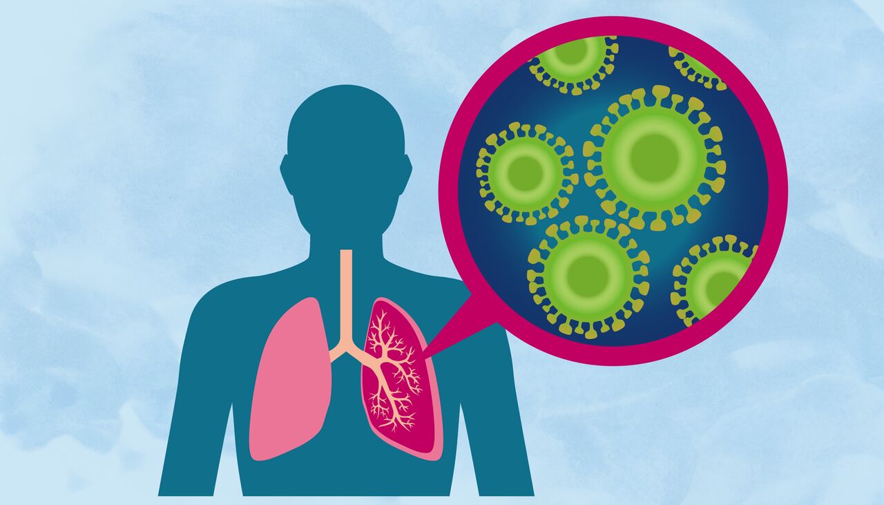 تصویری از ذاتالریه و ریههای آسیبدیده