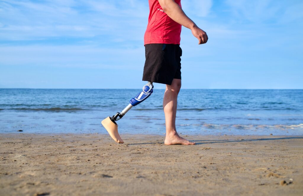 آینده در دستان شماست نوآوری های برتر پروتز پا تصویر 1