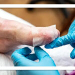 درخواست خانواده‌های بیماران ای‌بی از دولت گام‌های مؤثر برای رفع دغدغه‌های درمانی و دارویی بیماران پروانه‌ای