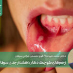 زخم‌های کوچک دهان؛ هشدار جدی سرطان