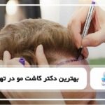 بهترین دکتر کاشت مو در تهران