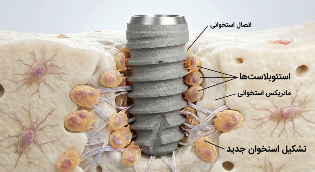 نکات مهم قبل و بعد از انجام ایمپلنت دندان برای نتیجه بهتر تصویر 2