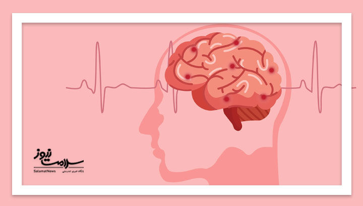 سکته کوچک؛ هشدار جدی برای ۹۰ روز سرنوشت‌ساز