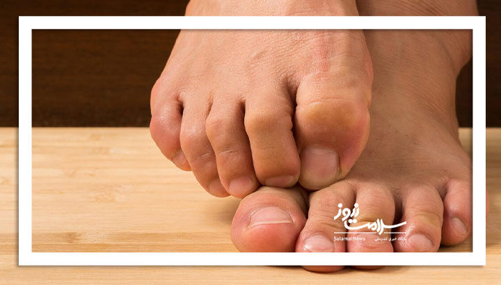 مراقب تغییرات کوچک در پا باشید