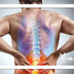 چطور دیسک کمر را تشخیص دهیم؟