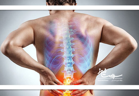 چطور دیسک کمر را تشخیص دهیم؟