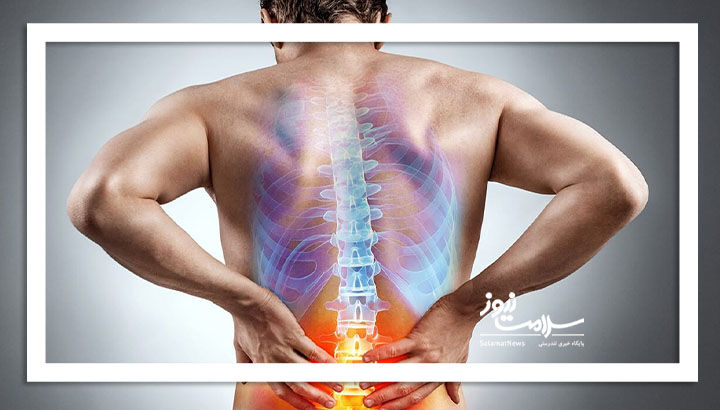 چطور دیسک کمر را تشخیص دهیم؟